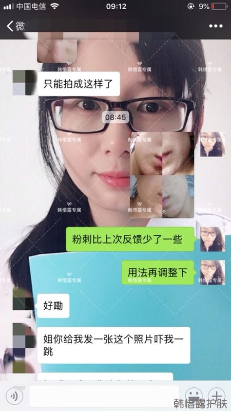 粉刺多怎么辦？按照要求配套耐心使用，粉刺消下去不少！