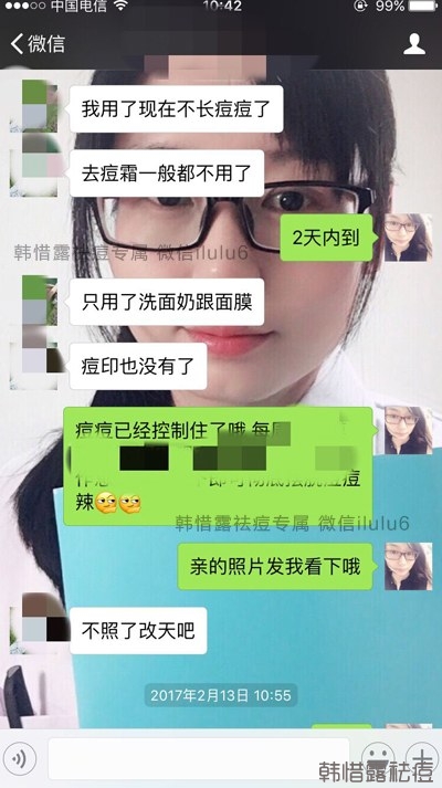 痘痘好了，再也沒有長過，懷孕8個月了！
