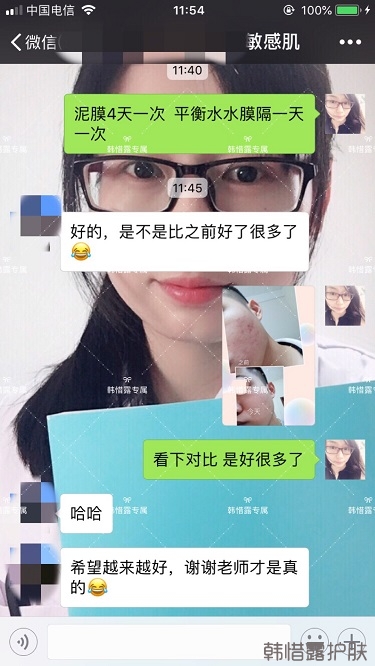 粉刺、痘痘、痘印、統統解決啦！祛痘去粉刺就是這么簡單！