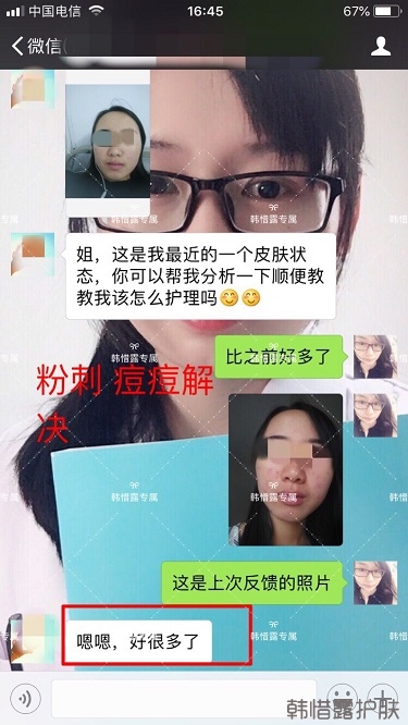 額頭長痘臉頰長痘痘粉刺，這樣調(diào)理幫你恢復(fù)嫩白肌膚！