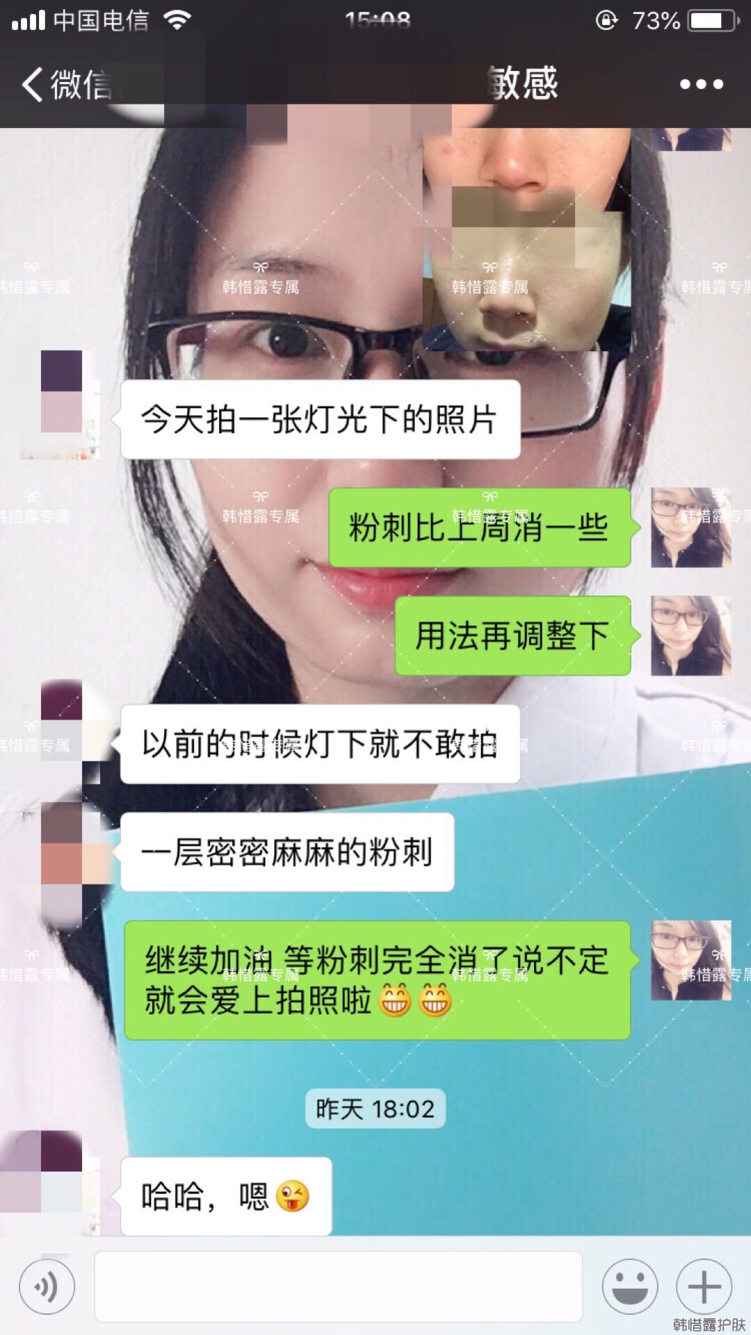粉刺痘痘怎么有效去除？以前不敢拍燈光下照片，粉刺少了，現(xiàn)在敢了！
