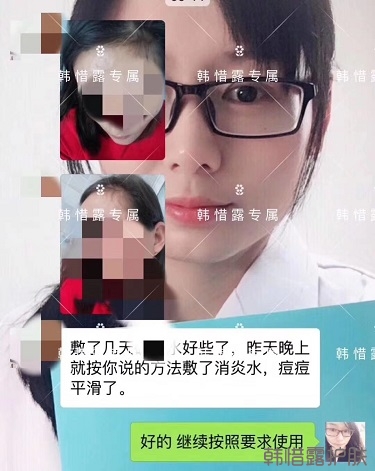什么產品祛痘效果好？有什么祛痘效果好的產品？