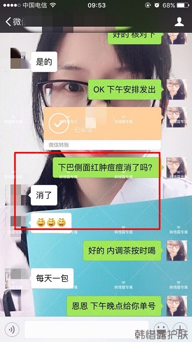 膿包結節發硬痘痘全消了，帥哥開心的來反饋了！