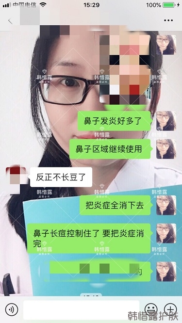 鼻子發紅長痘痘消了，皮膚吸收好就是任性！