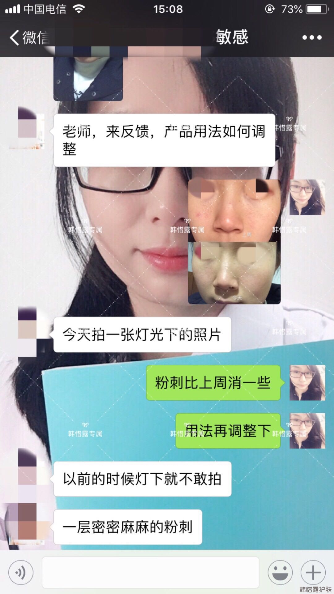 粉刺痘痘怎么有效去除？以前不敢拍燈光下照片，粉刺少了，現(xiàn)在敢了！