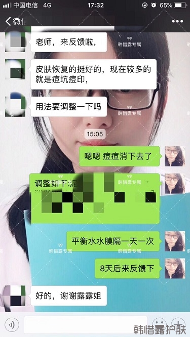 好好使用，膿包痘痘,小粉刺全消了,重點修復痘印痘坑印了