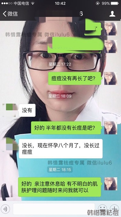 痘痘好了，再也沒有長過，懷孕8個月了！