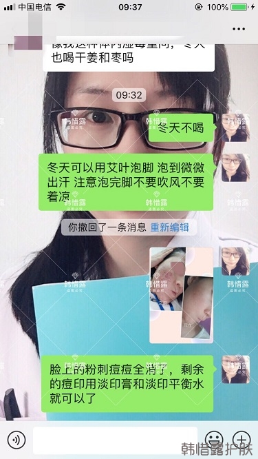 化妝品店主的變臉級祛痘反饋，粉刺痘痘全部消了