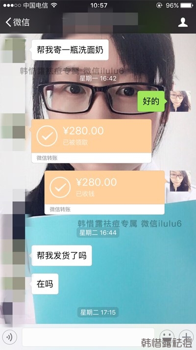 痘痘好了，再也沒有長過，懷孕8個月了！