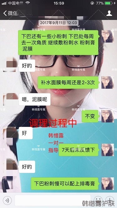 粉刺密密麻麻，試過很多方法無果后找韓惜露老師輕松去掉粉刺！