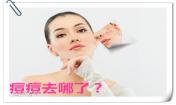 女生敏感期護(hù)理祛痘小妙招!